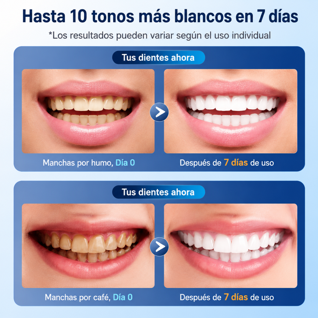 Blanqueador Dental LED portatil
